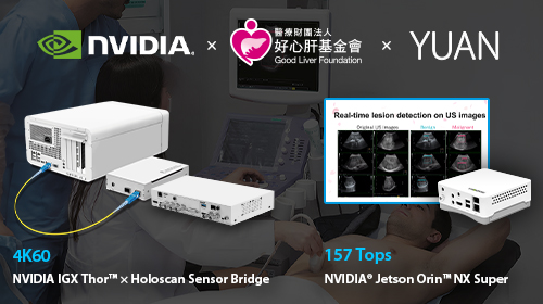 Bringing AI-Powered Healthcare to Rural Communities : 50 AI Ultrasound Systems Donated Across Taiwan